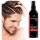 SEBORADIN MEN Hair Lotion for Hair Loss and Thinning 200ml - Hair & Scalp Treatment